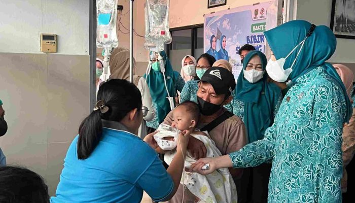 Operasi Bibir Sumbing Kalteng Buka Harapan Baru bagi Anak